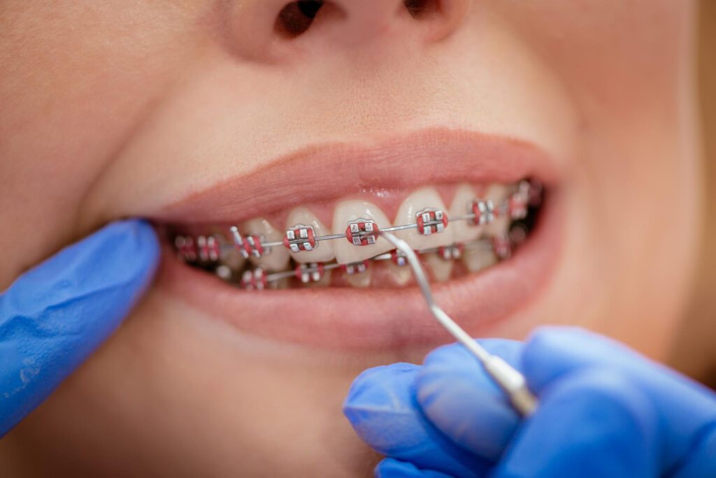 orthodontie en france