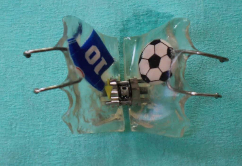 orthopedie plaque amovible football